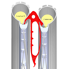 NoodLever Tubeless-Reifenheber